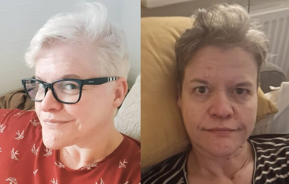 Kendal before and after long-covid